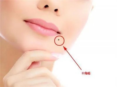 ​嘴巴上长痣的女人好不好？嘴巴上长痣怎么回事？