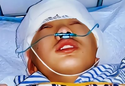 ​6年前13岁少年不顾劝阻，两次割下皮肤只为救父亲，后来怎么样了