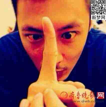 余文乐一只眼睛像瞎的，余文乐的眼睛是假的吗？余文乐大小眼原因