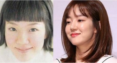 ​韩国没整容的明星，整容失败的明星有谁