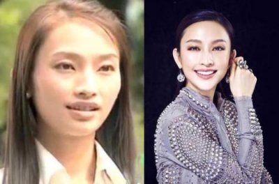 ​张俪整容，张俪的脸