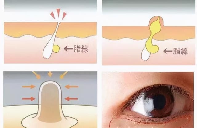 廖景萱的男朋友是谁(35岁廖景萱因离婚带两孩)