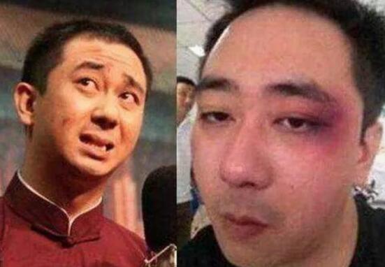 王自健被老婆打是真的吗 跟前妻离婚后又结婚了吗