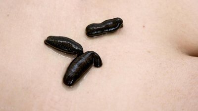 ​蚂蝗遇到盐为什么会死？蚂蝗吸血为生，它能在人的身体里生存吗？