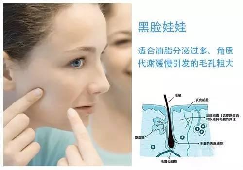 关于毛孔的知识你知道多少（为什么毛孔总来缠着你）(6)